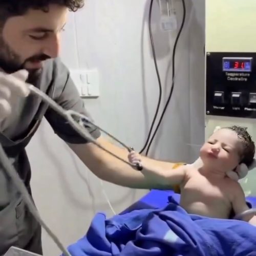 Bebê surpreende ao segurar estetoscópio de médico logo após nascer
